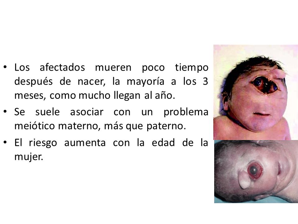 Los afectados mueren poco tiempo después de nacer, la mayoría a los 3 meses, como mucho llegan al año.
