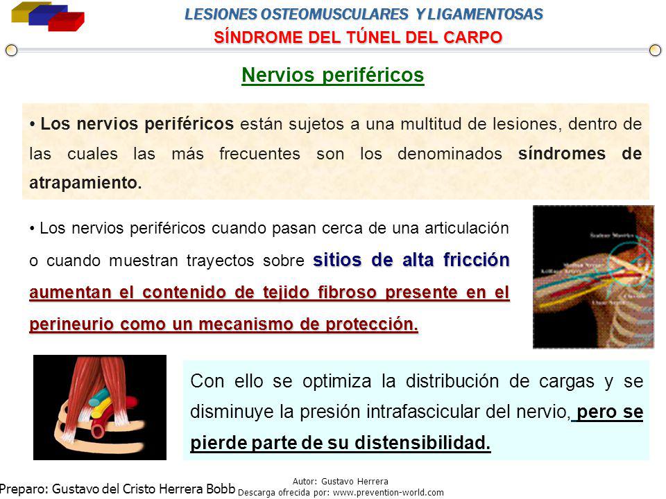 Nervios periféricos