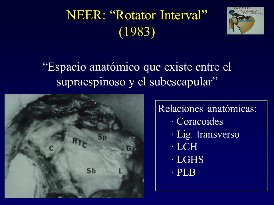 NEER: Rotator Interval (1983) Espacio anatómico que existe entre el supraespinoso y el subescapular