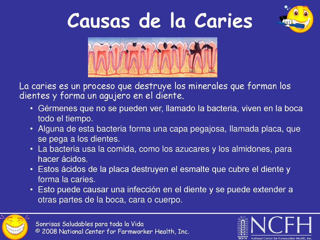 Causas de la Caries La caries es un proceso que destruye los minerales que forman los dientes y forma un agujero en el diente.