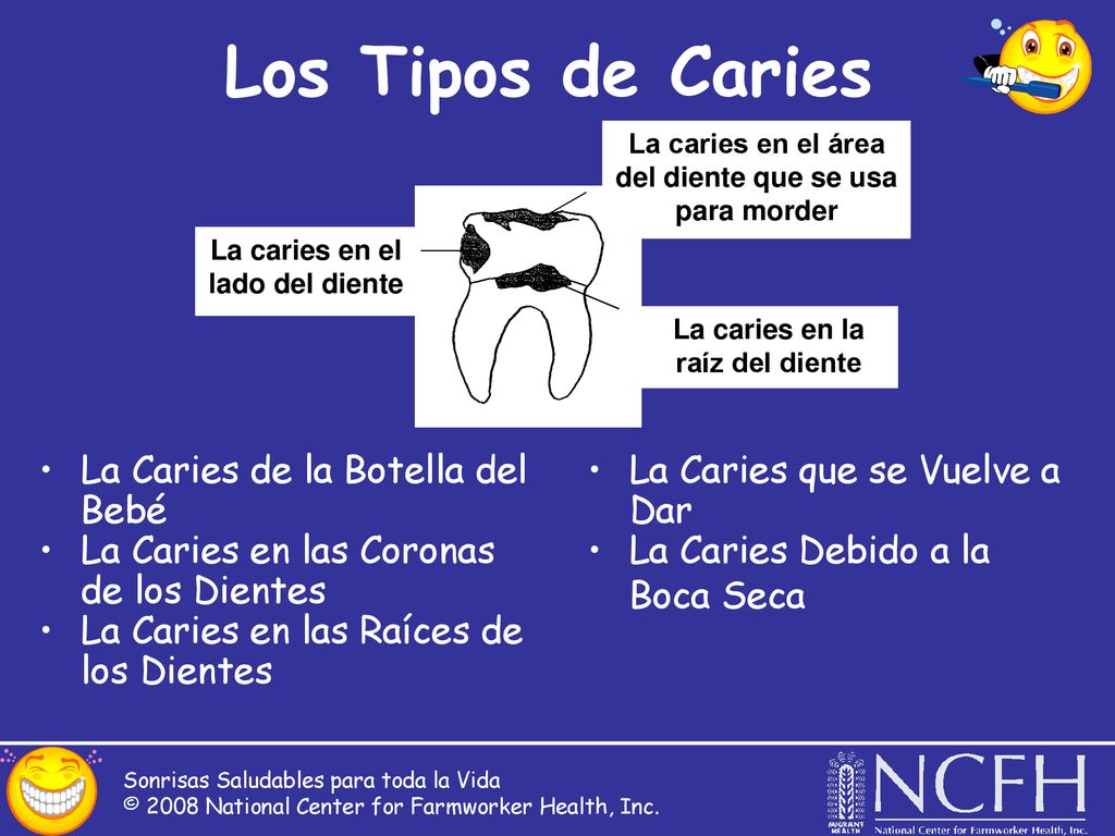 Los Tipos de Caries La Caries de la Botella del Bebé