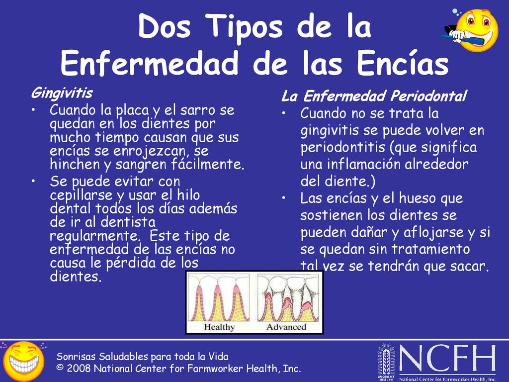 Dos Tipos de la Enfermedad de las Encías
