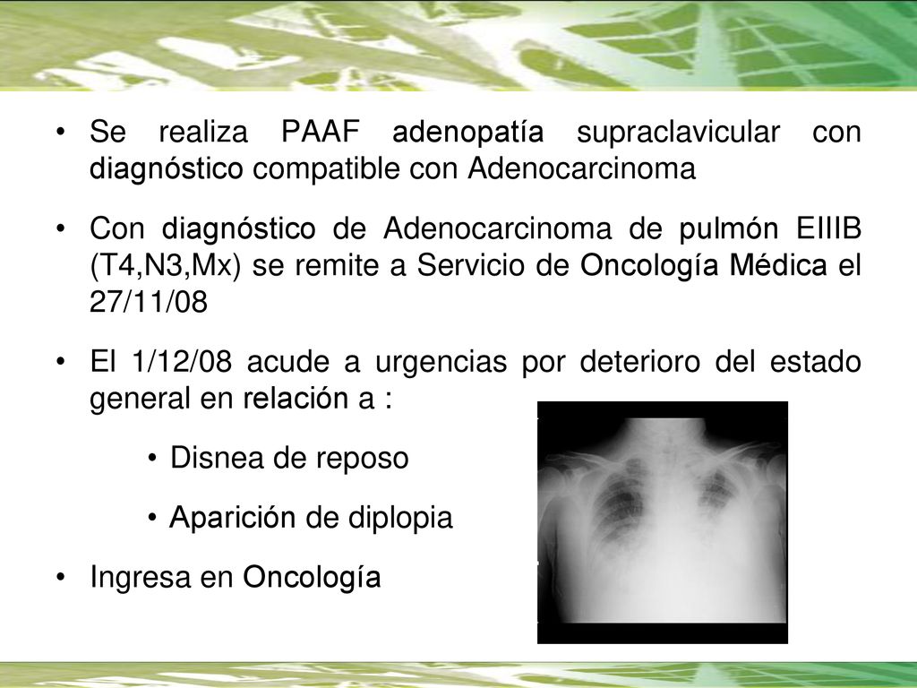 Se realiza PAAF adenopatía supraclavicular con diagnóstico compatible con Adenocarcinoma