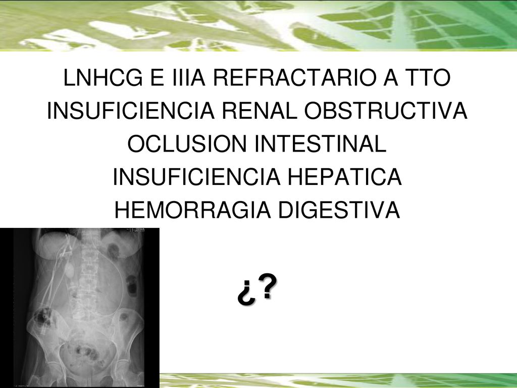 ¿ LNHCG E IIIA REFRACTARIO A TTO INSUFICIENCIA RENAL OBSTRUCTIVA