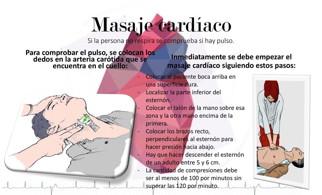 Masaje cardíaco Si la persona no respira se comprueba si hay pulso.