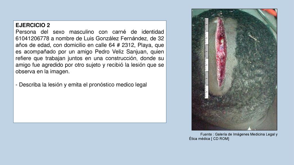 - Describa la lesión y emita el pronóstico medico legal