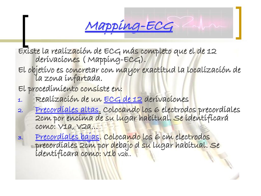 Mapping-ECG Existe la realización de ECG más completo que el de 12 derivaciones ( Mapping-ECG).