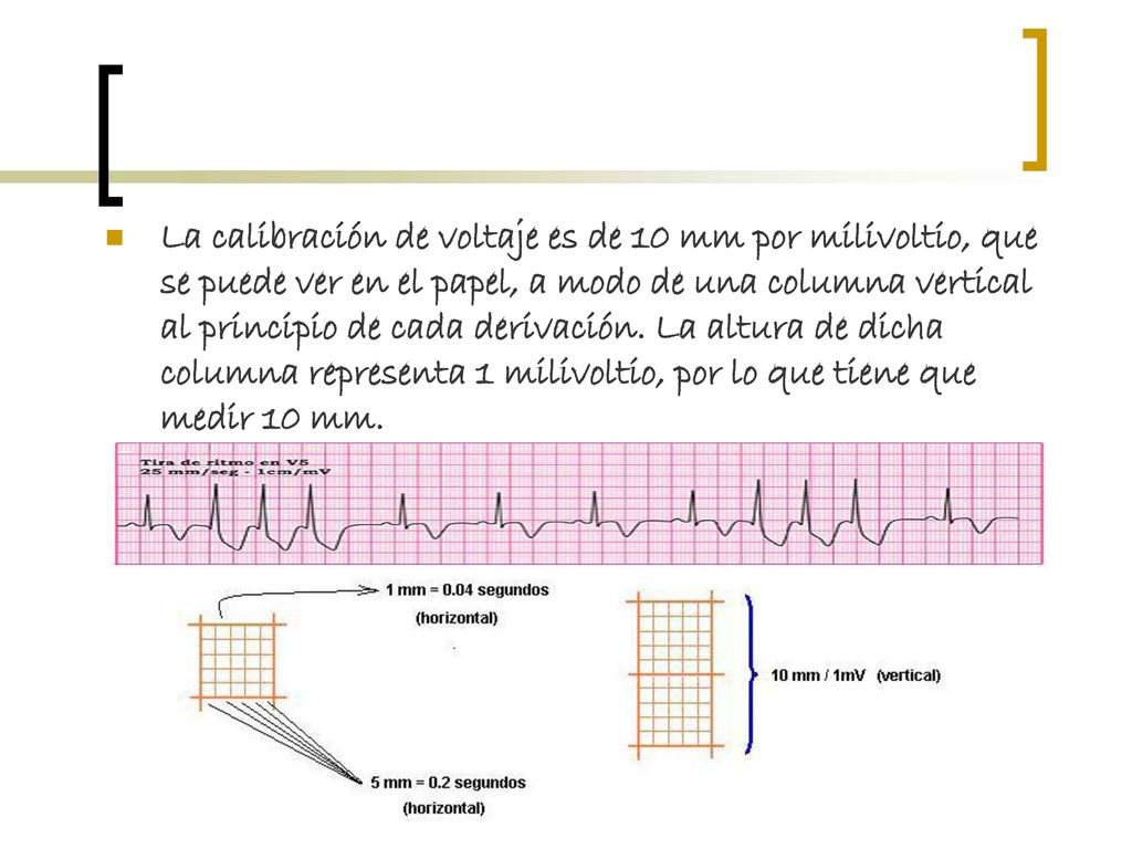 La calibración de voltaje es de 10 mm por milivoltio, que se puede ver en el papel, a modo de una columna vertical al principio de cada derivación.