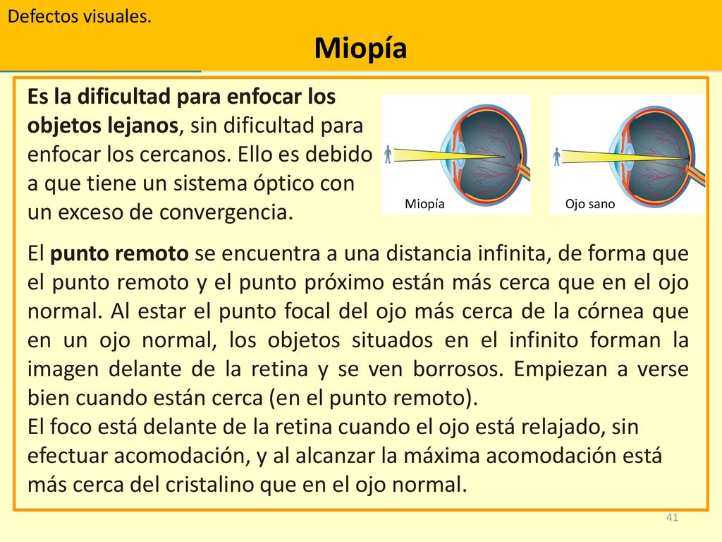 Defectos visuales. Miopía. Es la dificultad para enfocar los objetos lejanos, sin dificultad para enfocar los cercanos. Ello es debido.