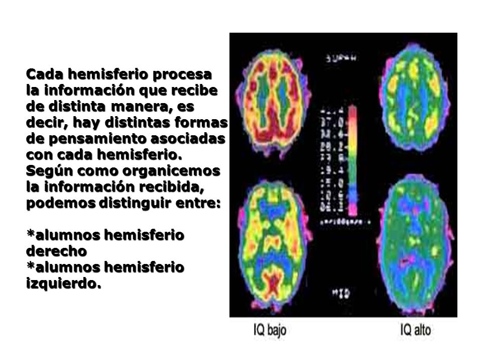 Cada hemisferio procesa la información que recibe de distinta manera, es decir, hay distintas formas de pensamiento asociadas con cada hemisferio.