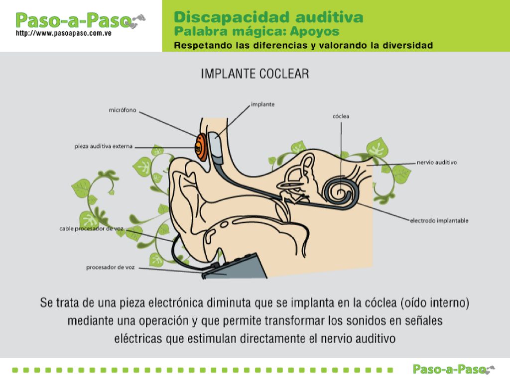 Para algunos niños que no pueden oír o entender las palabras con este tipo de aparatos, existe otro dispositivo denominado IMPLANTE COCLEAR.