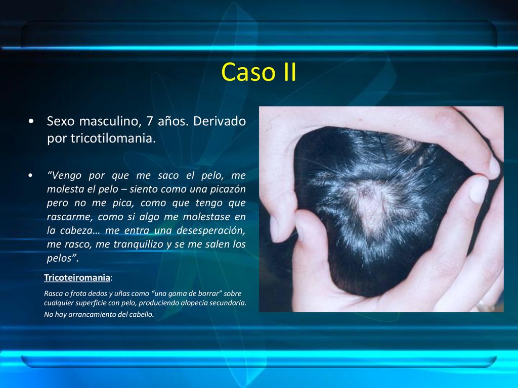 Caso II Sexo masculino, 7 años. Derivado por tricotilomania.