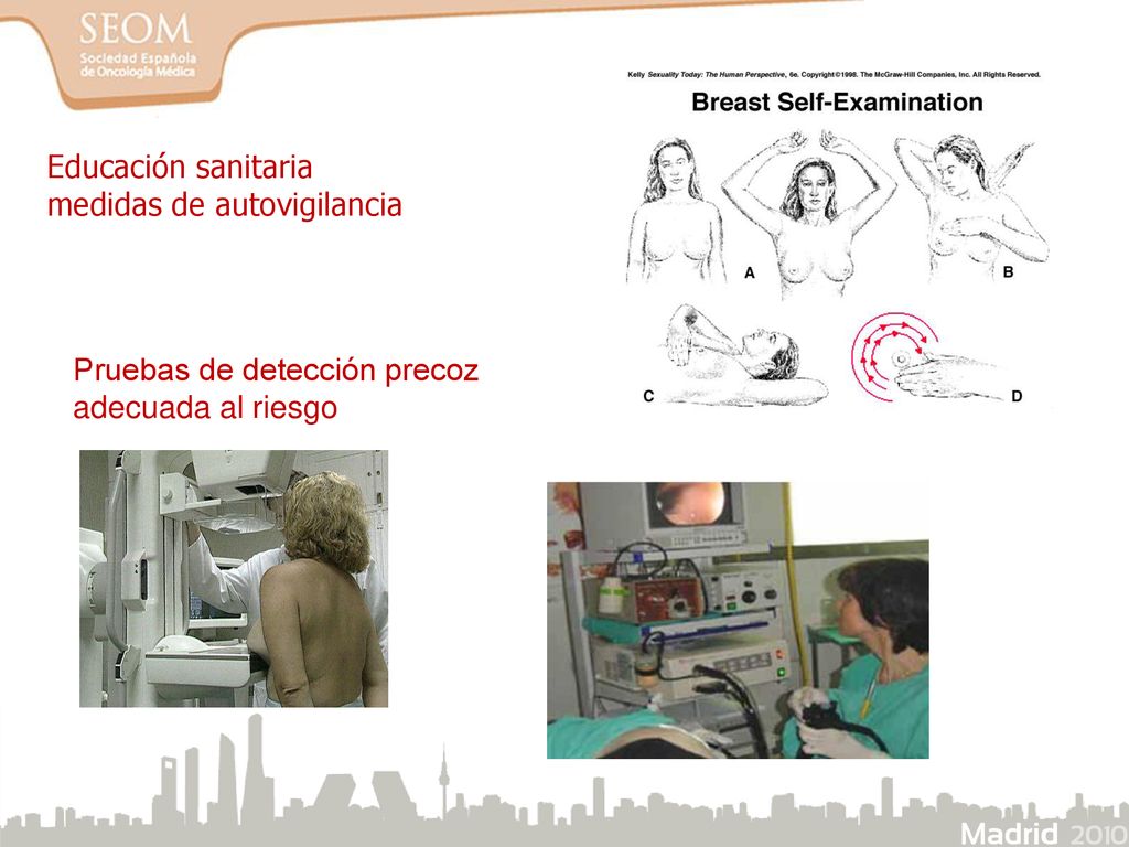 Educación sanitaria medidas de autovigilancia Pruebas de detección precoz adecuada al riesgo