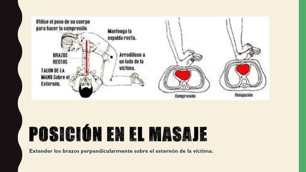POSICIÓN EN EL MASAJE Extender los brazos perpendicularmente sobre el esternón de la víctima.
