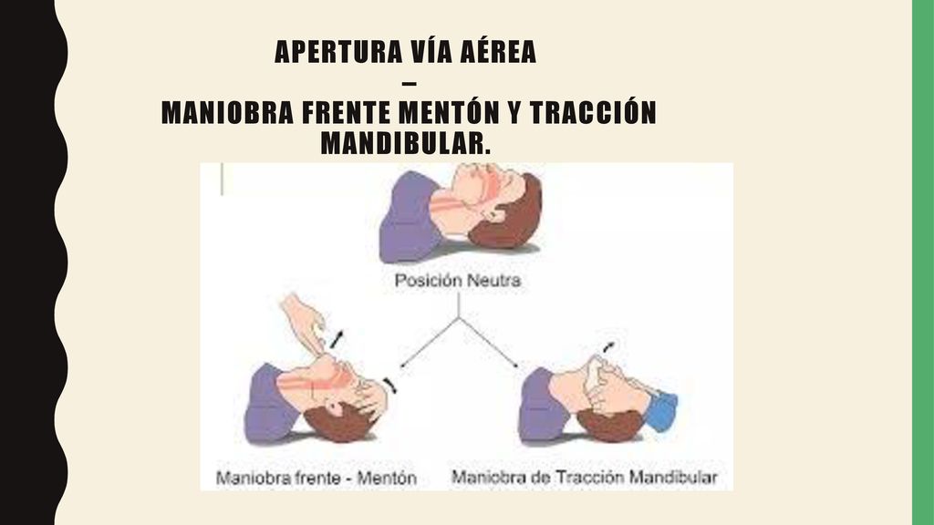 APERTURA VÍA AÉREA – MANIOBRA FRENTE MENTÓN Y TRACCIÓN MANDIBULAR.