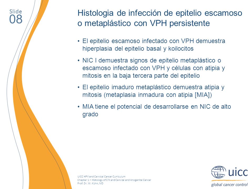 Slide Histologia de infección de epitelio escamoso o metaplástico con VPH persistente. 08.