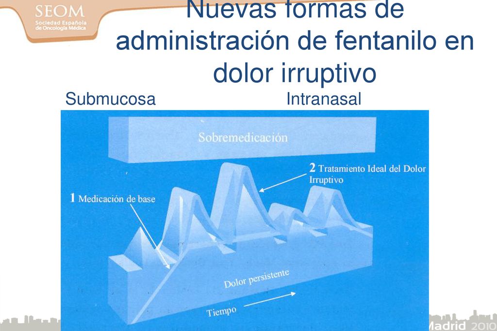 Nuevas formas de administración de fentanilo en dolor irruptivo