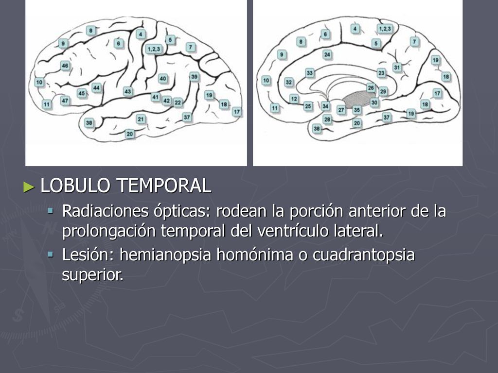 LOBULO TEMPORAL Radiaciones ópticas: rodean la porción anterior de la prolongación temporal del ventrículo lateral.