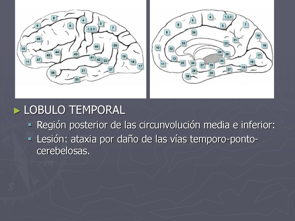 LOBULO TEMPORAL Región posterior de las circunvolución media e inferior: Lesión: ataxia por daño de las vías temporo-ponto-cerebelosas.