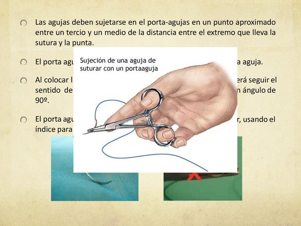 Las agujas deben sujetarse en el porta-agujas en un punto aproximado entre un tercio y un medio de la distancia entre el extremo que lleva la sutura y la punta.