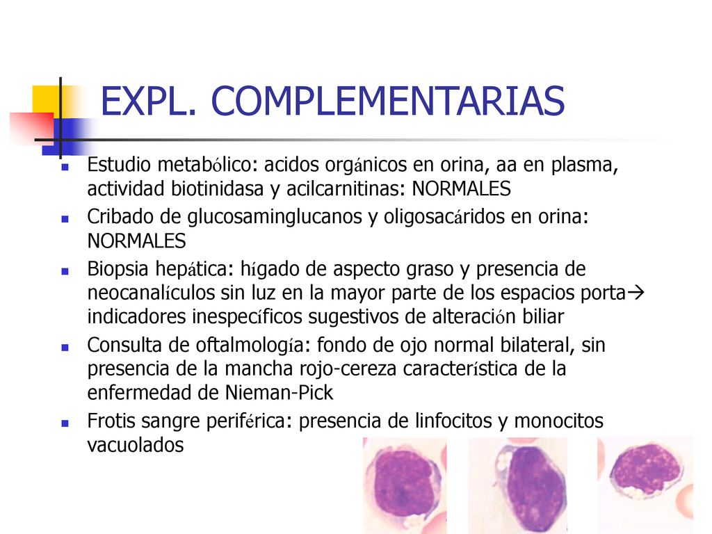 EXPL. COMPLEMENTARIAS Estudio metabólico: acidos orgánicos en orina, aa en plasma, actividad biotinidasa y acilcarnitinas: NORMALES.
