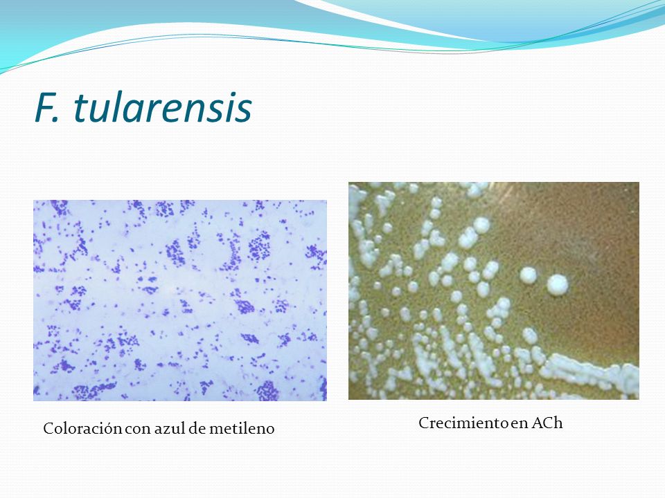 F. tularensis Crecimiento en ACh Coloración con azul de metileno