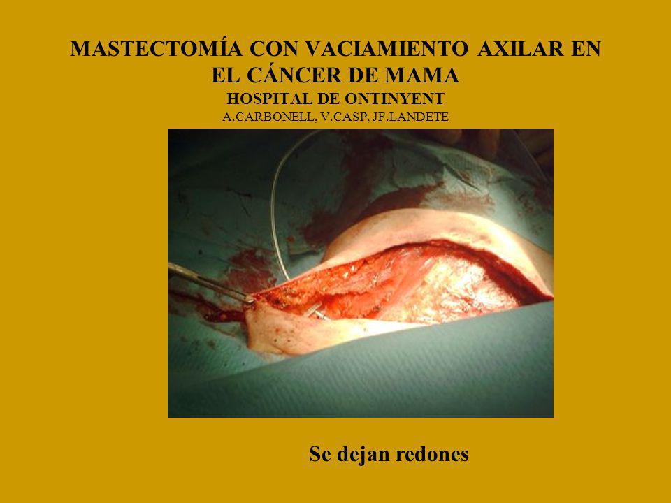 MASTECTOMÍA CON VACIAMIENTO AXILAR EN EL CÁNCER DE MAMA HOSPITAL DE ONTINYENT A.CARBONELL, V.CASP, JF.LANDETE