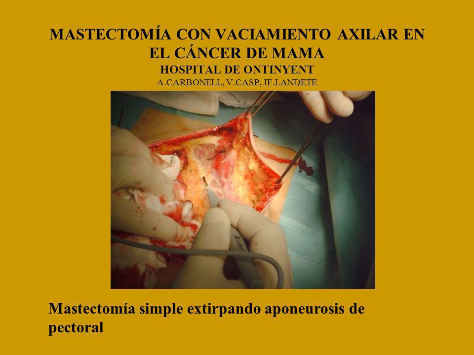MASTECTOMÍA CON VACIAMIENTO AXILAR EN EL CÁNCER DE MAMA HOSPITAL DE ONTINYENT A.CARBONELL, V.CASP, JF.LANDETE