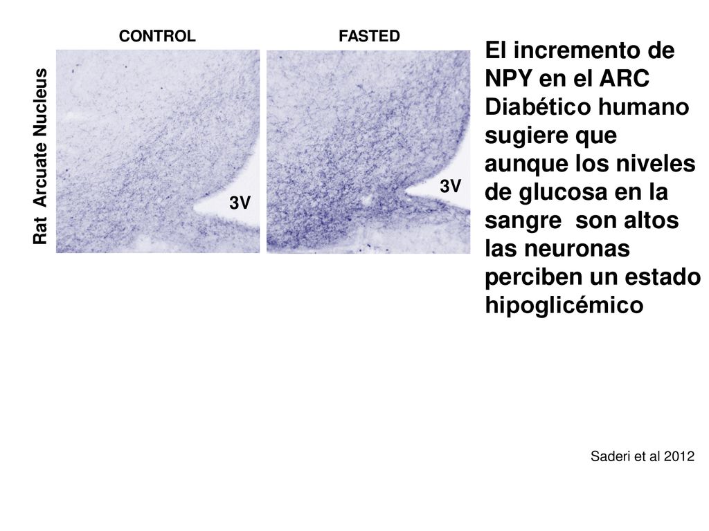 3V Rat Arcuate Nucleus. Human Arcuate Nucleus. CONTROL. FASTED. DIABETIC.