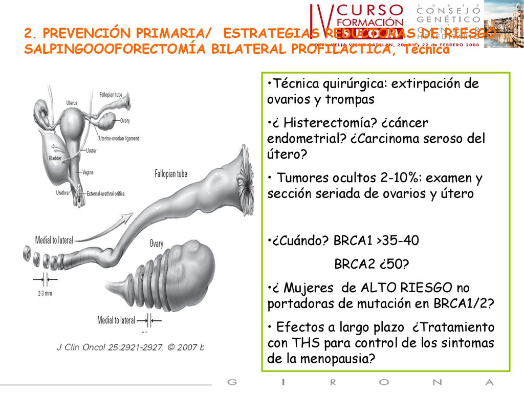 2. PREVENCIÓN PRIMARIA/ ESTRATEGIAS REDUCTORAS DE RIESGO: SALPINGOOOFORECTOMÍA BILATERAL PROFILACTICA, Técnica