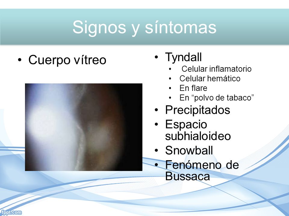 Signos y síntomas Signos y síntomas Cuerpo vítreo Tyndall Precipitados