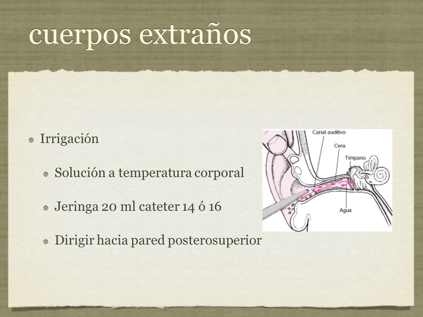 cuerpos extraños Irrigación Solución a temperatura corporal