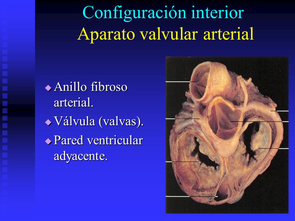 Configuración interior Aparato valvular arterial