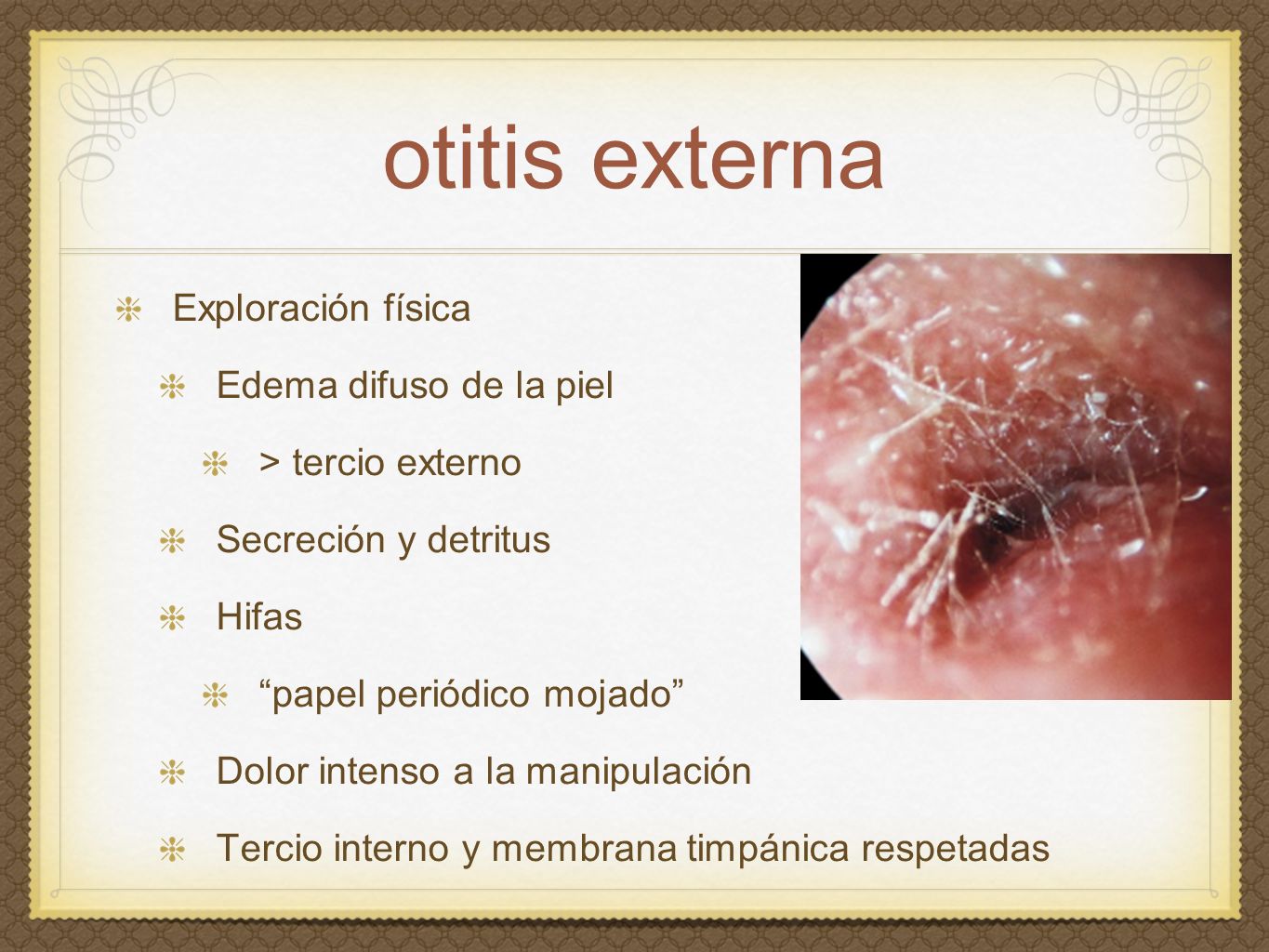 otitis externa Exploración física Edema difuso de la piel