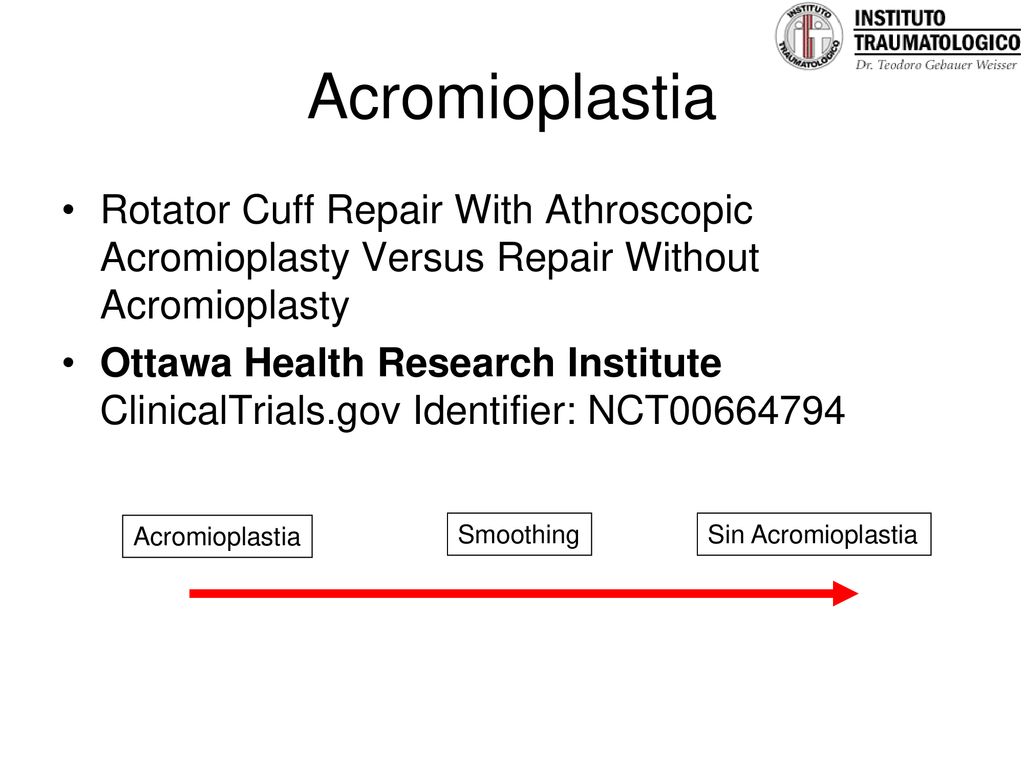 Acromioplastia Rotator Cuff Repair With Athroscopic Acromioplasty Versus Repair Without Acromioplasty.