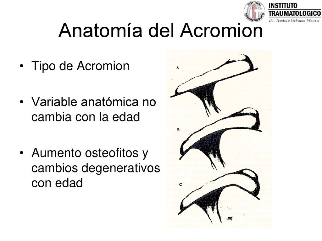 Anatomía del Acromion Tipo de Acromion