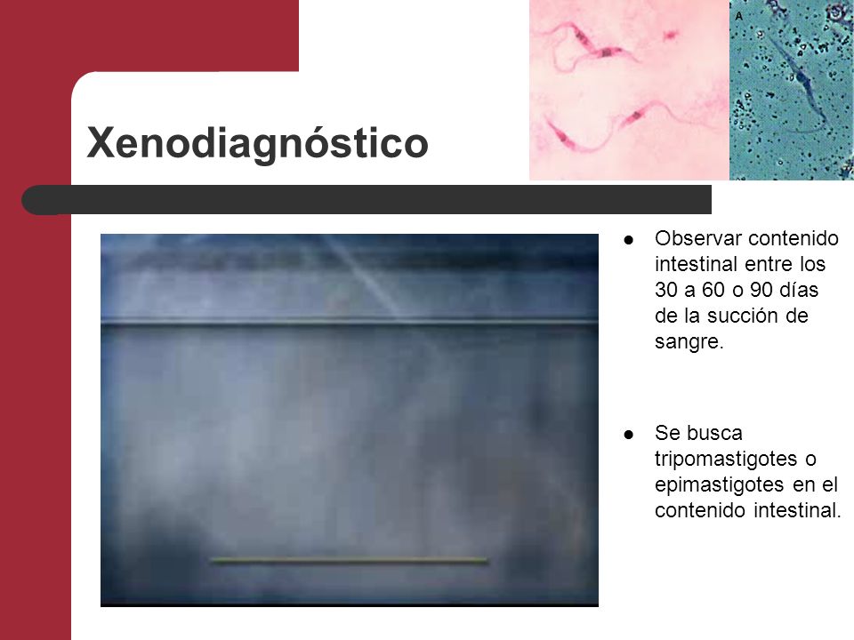 Xenodiagnóstico Observar contenido intestinal entre los 30 a 60 o 90 días de la succión de sangre.