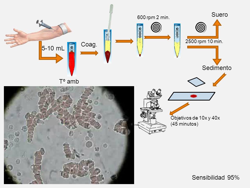 Suero Coag mL Sedimento Tº amb Sensibilidad 95% 600 rpm 2 min.