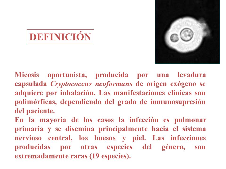 DEFINICIÓN