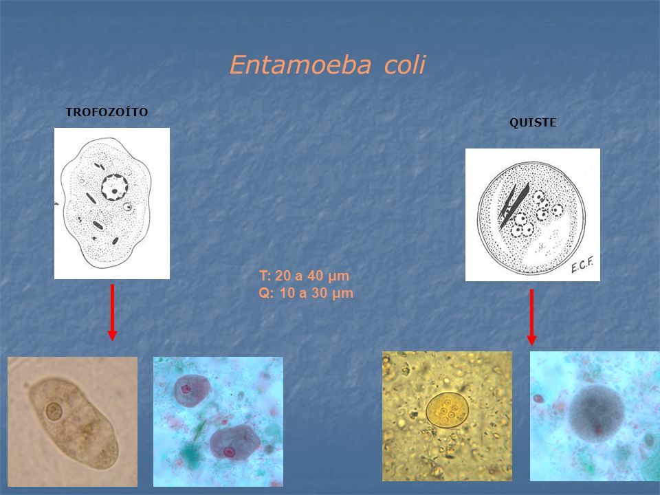 Entamoeba coli TROFOZOÍTO QUISTE T: 20 a 40 μm Q: 10 a 30 μm
