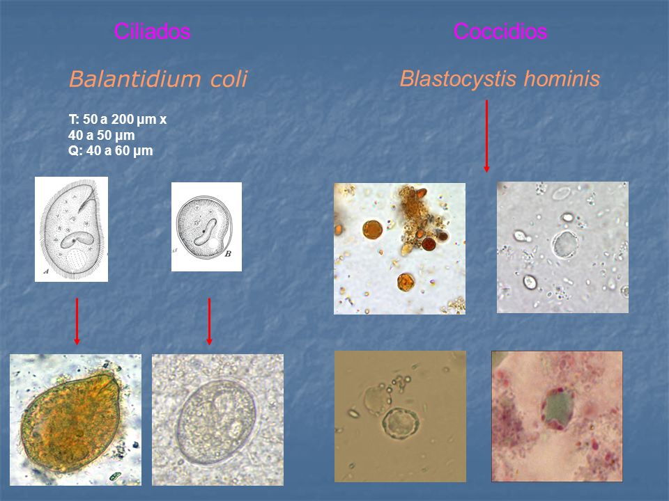 Ciliados Coccidios Balantidium coli Blastocystis hominis