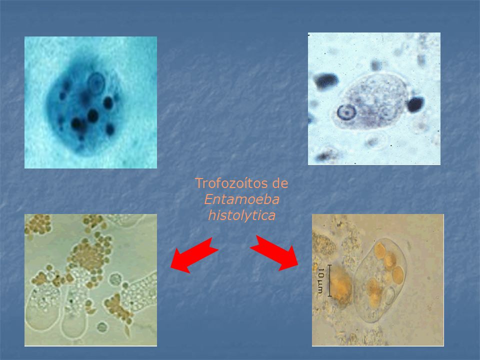 Trofozoítos de Entamoeba histolytica
