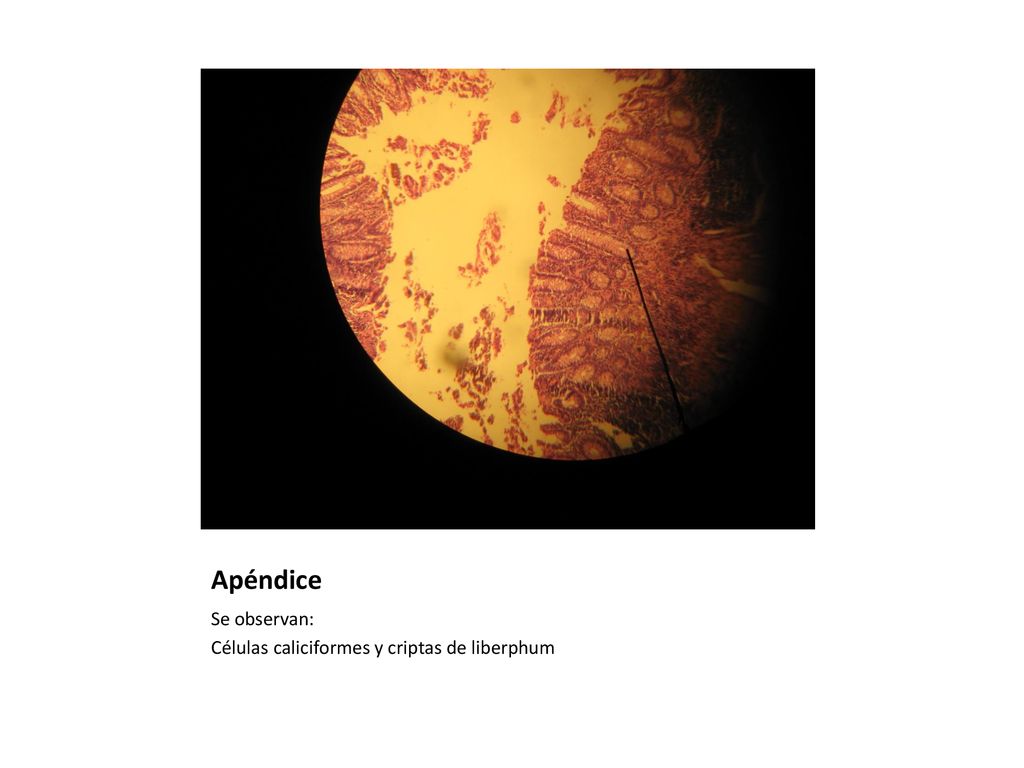 Apéndice Se observan: Células caliciformes y criptas de liberphum