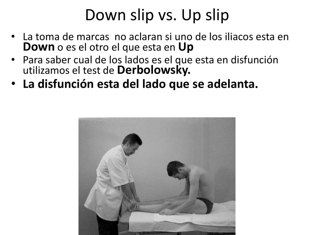 Down slip vs. Up slip La disfunción esta del lado que se adelanta.