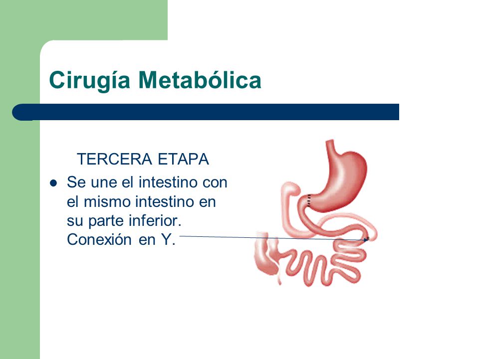 Cirugía Metabólica TERCERA ETAPA