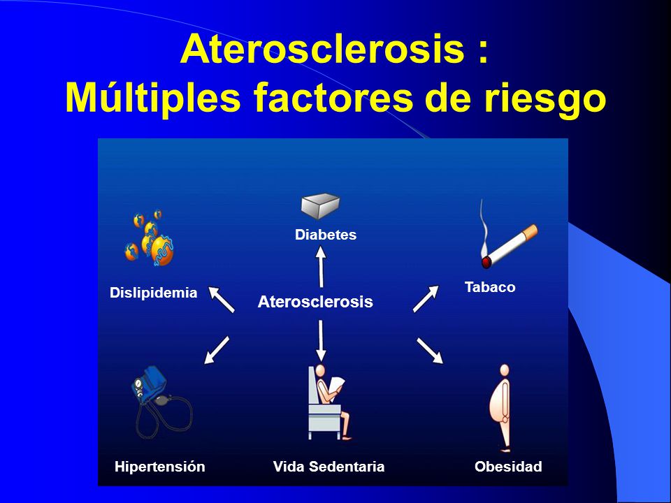 Aterosclerosis : Múltiples factores de riesgo