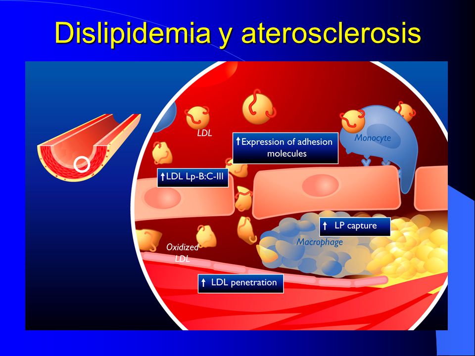 Dislipidemia y aterosclerosis