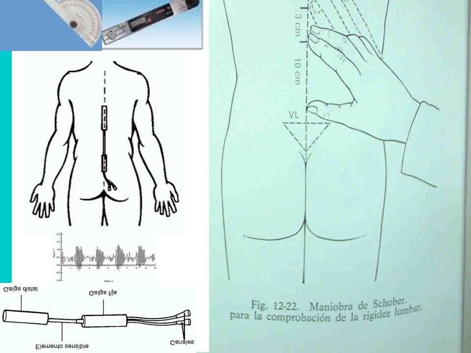 30 cm debajo de C7 10 cm arriba de LV Normal aumenta 5 cm