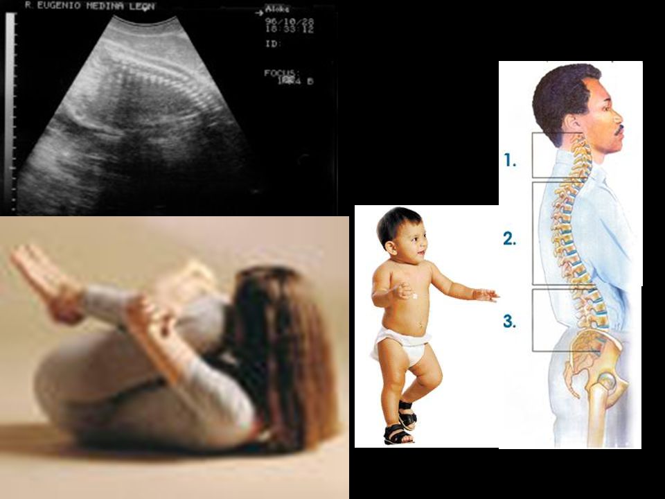 Otro cambio significativo que repercute en la columna es el paso que representa en la posición fetal donde se encuentra una única cifosis, al momento del nacimiento y más aún, cuando empieza el niño a caminar donde se transforma en las diferentes curvaturas conocidas (lordosis cervical, difosis toracia, lordosis lumbar, cifosis sacra