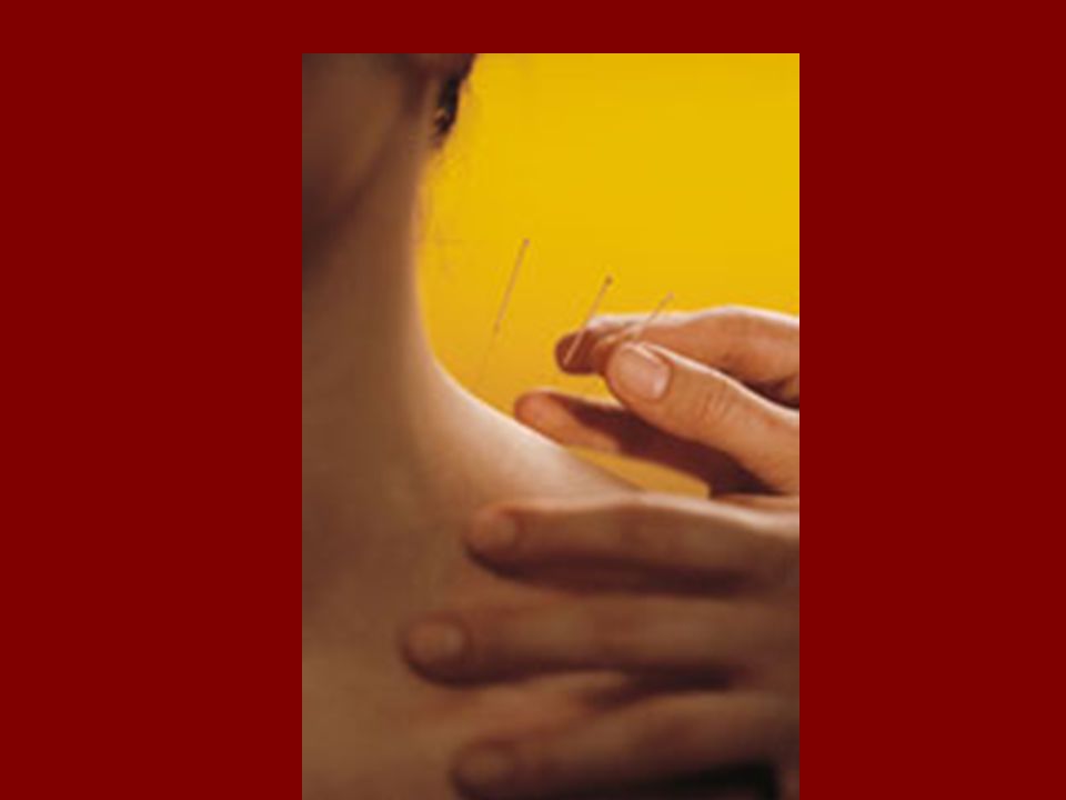La acupuntura se utiliza frecuentemente en los Estados Unidos como tratamiento para diversas enfermedades y síntomas, incluido el dolor lumbar. Es un tratamiento que se desarrolló originariamente en China, hace más de 2000 años y, se ha convertido en un método usual en ese país para aliviar el dolor y otros síntomas. Además de estudiar el papel que desempeña la acupuntura en el tratamiento del dolor lumbar, el Instituto Nacional de Salud ha subsidiado varias investigaciones sobre la eficacia de la acupuntura en el tratamiento de las náuseas y los vómitos asociados con el embarazo, la quimioterapia y el período post quirúrgico. La acupuntura también se ha estudiado como tratamiento útil para la adicción al tabaco, el alcohol y las drogas, incluso como método para aliviar los dolores de cabeza, los calambres menstruales, el codo de tenista, el síndrome de túnel carpiano y el asma.
